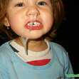 Small_snotty_girl